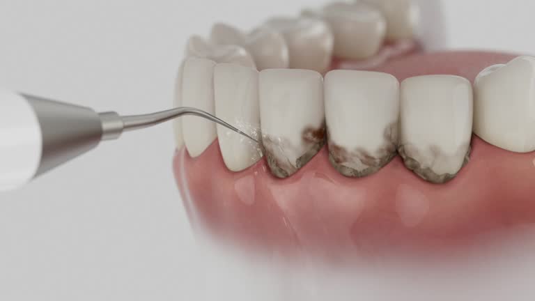 Reliable Emergency Dentist contractor in Eureka, MO by Smile Center Dentistry
